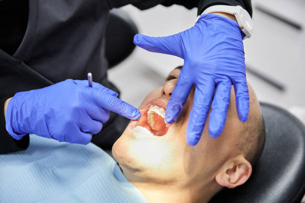 Best Knocked-Out Tooth Emergency  in Hawaiian Gardens, CA